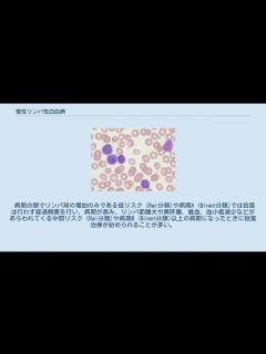 [x]慢性リンパ性白血病 - YouTube