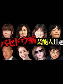 [x]バセドウ病を罹患している芸能人11選 - YouTube
