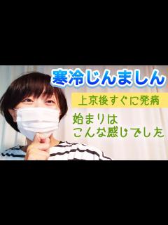 [x]初めて寒冷蕁麻疹が出た時から、病院で診断されるまで - YouTube