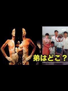 [x]「弟はどこ？」豪州で開催中の人体標本展 兄がDNA鑑定を要求| ニュース | 新唐人| 報道 | 臓器 海外 - YouTube